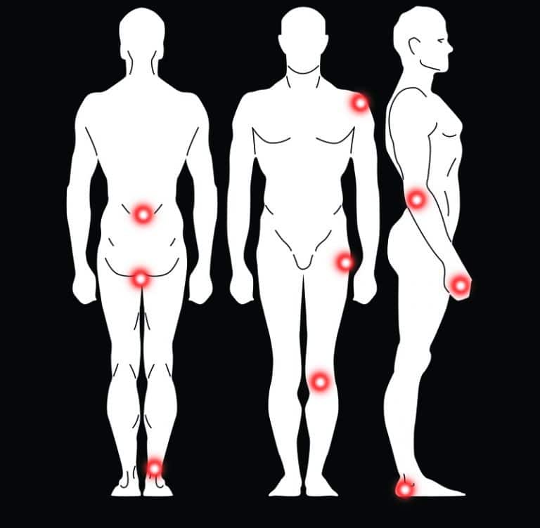 כאבים בכתף: כתף קפואה, שכמות, הסתיידות, דלקות, שינויים ניווניים כאבים במרפק: מרפק טניס, מרפק גולף כאבים בכף היד: טריגר פינגר, התעלה הקרפלית, דה קרווין,תעלת הקוביטל כאבים בגב תחתון: אישיאס, דלקות, שינויים ניווניים כאבים ברצפת האגן: הסתיידות, דלקות, שינויים ניווניים כאבים בירך: טרוכנטריק בורסיטיס, הסתיידות, דלקות, שינויים ניווניים כאבים בברך: הסתיידוית גידים, דלקות גידים, שינויים ניווניים בסחוס כאבים בגיד אכילס: הסתיידות, דלקות, שינויים ניווניים כאבים בכף הרגל: דורבן, מורטון נוירומה, מטטרסלגיה, רגל כבדה, נימול, הסתיידות,דלקות, שינויים ניווניים